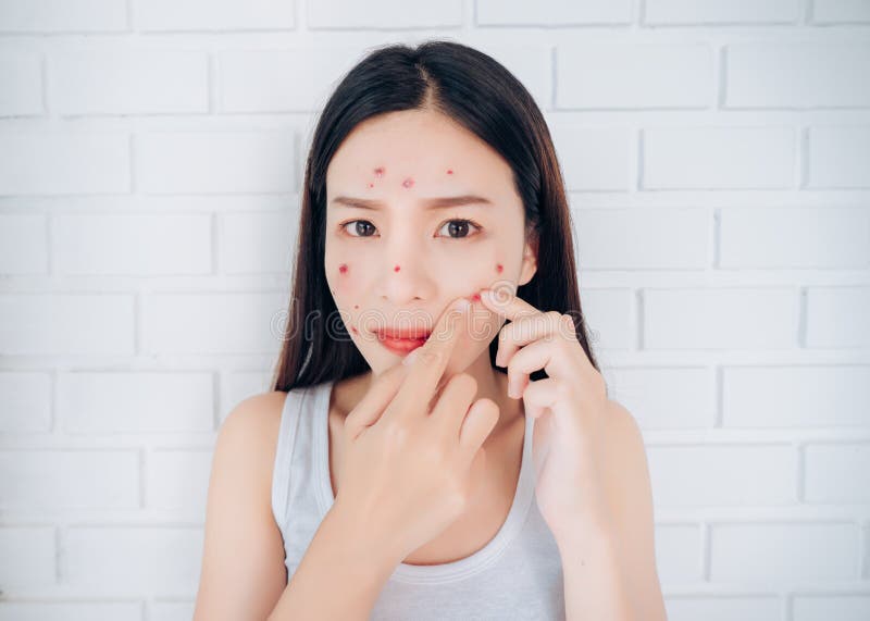 Young Asian woman squeeze acne cheeks problem face looking at mirror her without Skincare. Young Asian woman squeeze acne cheeks problem face looking at mirror her without Skincare