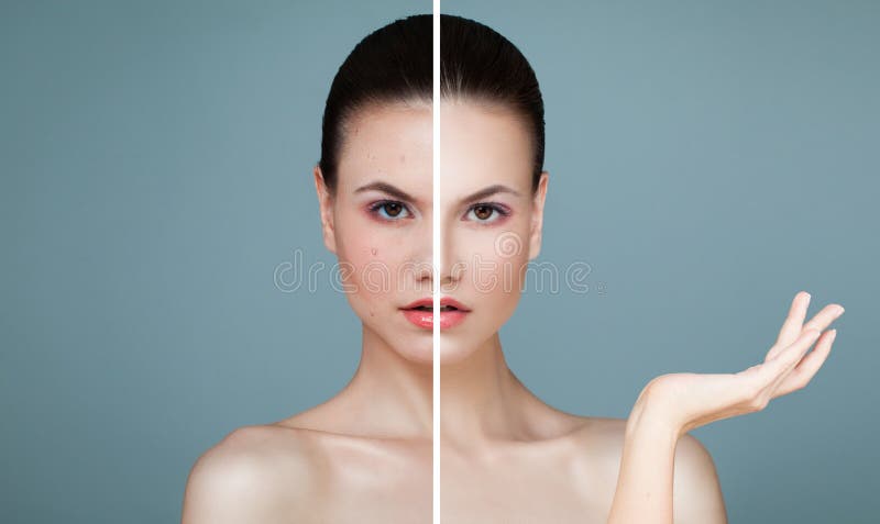 Cara femenina joven con problema de piel y la piel clara imagen de archivo Cara femenina joven con problema de piel y la piel clara imagen de archivo