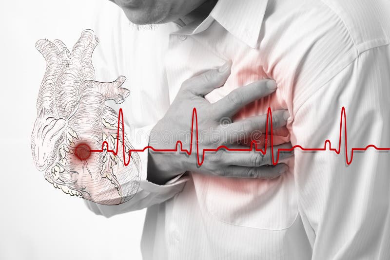 Cardiogram do cardíaco de ataque e das batidas de coração