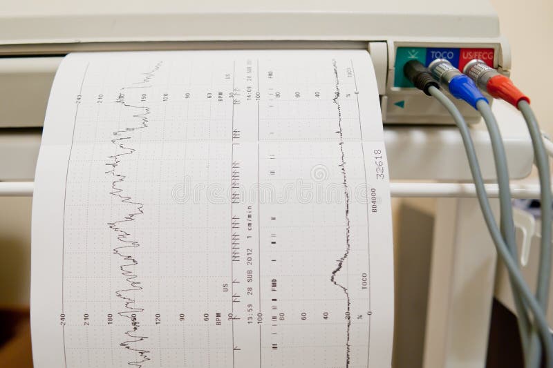 Cardiogram Ekg Innerimpuls auf dem Zeichenpapier mit Maßeinteilung lizenzfreie stockfotografie Cardiogram Ekg Innerimpuls auf dem Zeichenpapier mit Maßeinteilung lizenzfreie stockfotografie