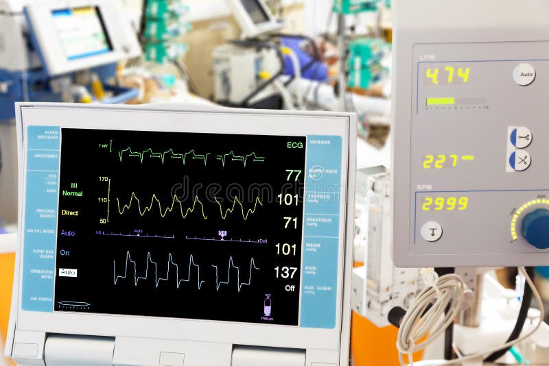 cardiogramecmo royaltyfri fotografi cardiogramecmo royaltyfri fotografi