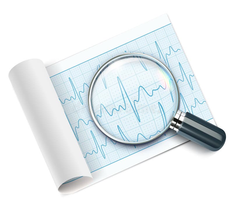 Vector illustration of cardiogram under magnifying glass. Vector illustration of cardiogram under magnifying glass