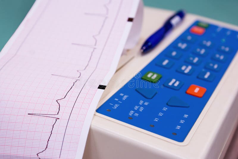 pics of a cardiograph pics of a cardiograph