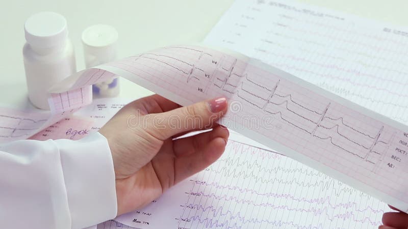 Cardiologo che studia attività del cuore del paziente, elettrocardiogramma d'esame, elettrocardiogramma