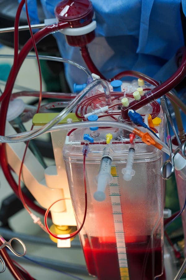 Cardiopulmonary Bypass,circulation Blood Heart Lung Machine Stock Image - Image of mask, cardiopulmonary: 206572269