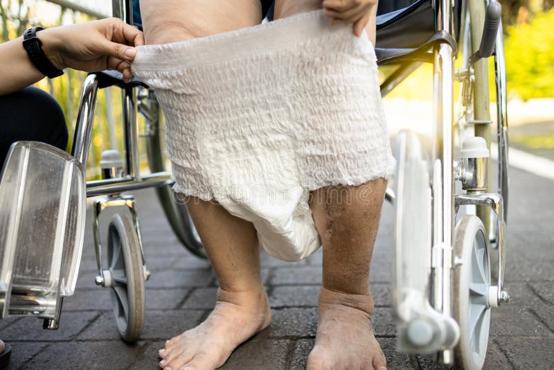 Caring female nurse assisting a elderly patient with giving diaper change,asian senior woman put nappy,disposable diaper,disabled old people with bladder control problem,stress urinary incontinence