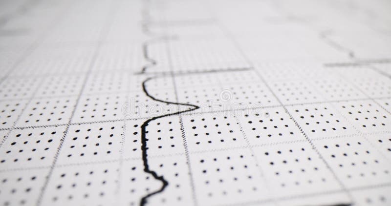 Carta elettrocardiogramma su carta perforata in clinica