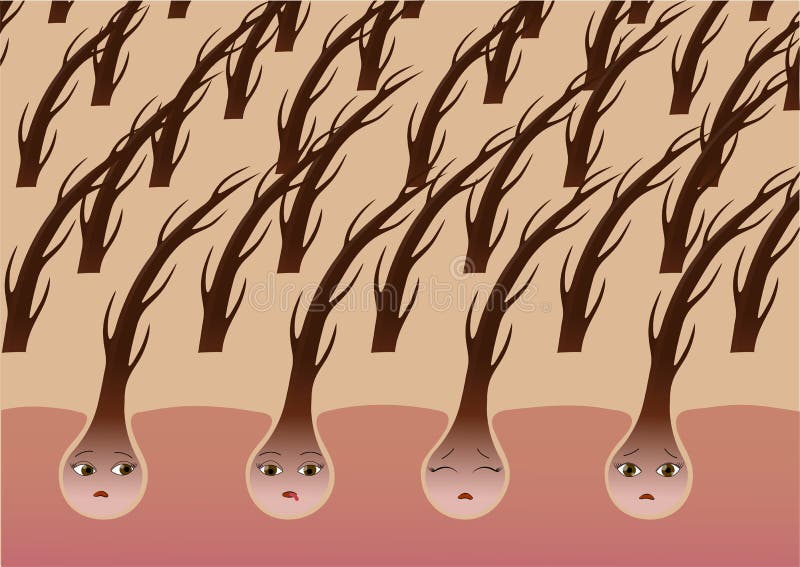 Cartoon Hair Follicles on the Scalp Suffer from Dryness Stock Vector -  Illustration of medicine, fear: 110540045