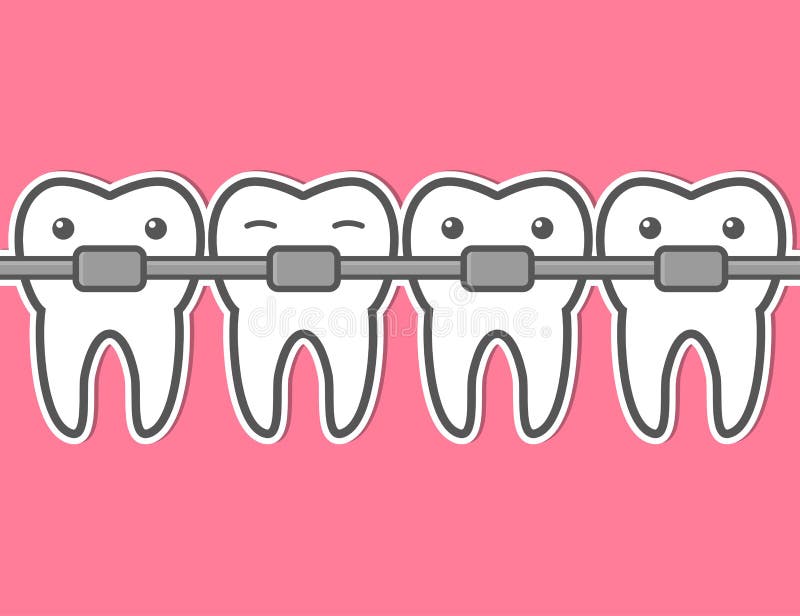 Cartoon tooth braces. 