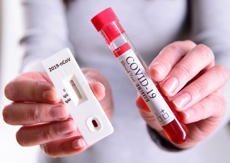 Cassete de teste rápida de fita de coronavírus - 19 para anticorpos ou doença do vírus sars-cov- 2 em mãos conceito epidêmico pla fotos de stock Cassete de teste rápida de fita de coronavírus - 19 para anticorpos ou doença do vírus sars-cov- 2 em mãos conceito epidêmico pla fotos de stock