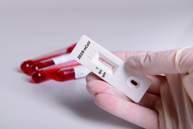 Cassete de teste rápido de fita de coronavírus - 19 para anticorpos ou vírus sars-cov- 2 na mão e na epidemia de tubo de teste sa imagens de stock Cassete de teste rápido de fita de coronavírus - 19 para anticorpos ou vírus sars-cov- 2 na mão e na epidemia de tubo de teste sa imagens de stock