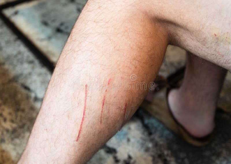 Scratch Marks Cat Photos Free & RoyaltyFree Stock Photos from Dreamstime