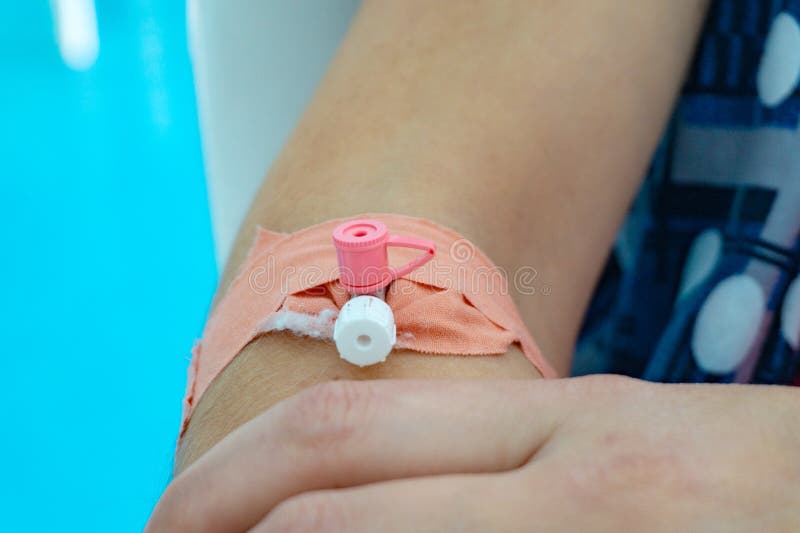 The catheter is in the girl’s hand, and the doctor examines the patient stock images The catheter is in the girl’s hand, and the doctor examines the patient stock images