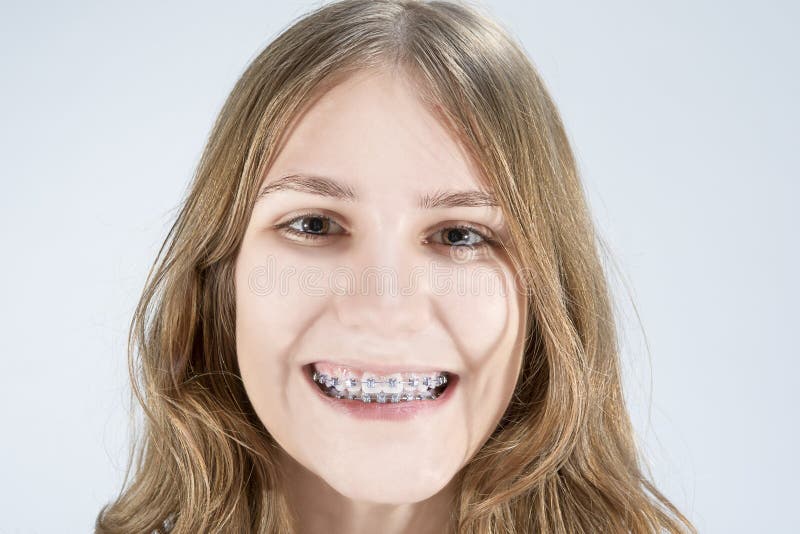 Caucasian Teenage Girl Showing Her Teeth Brackets Posing Indoor Stock ...