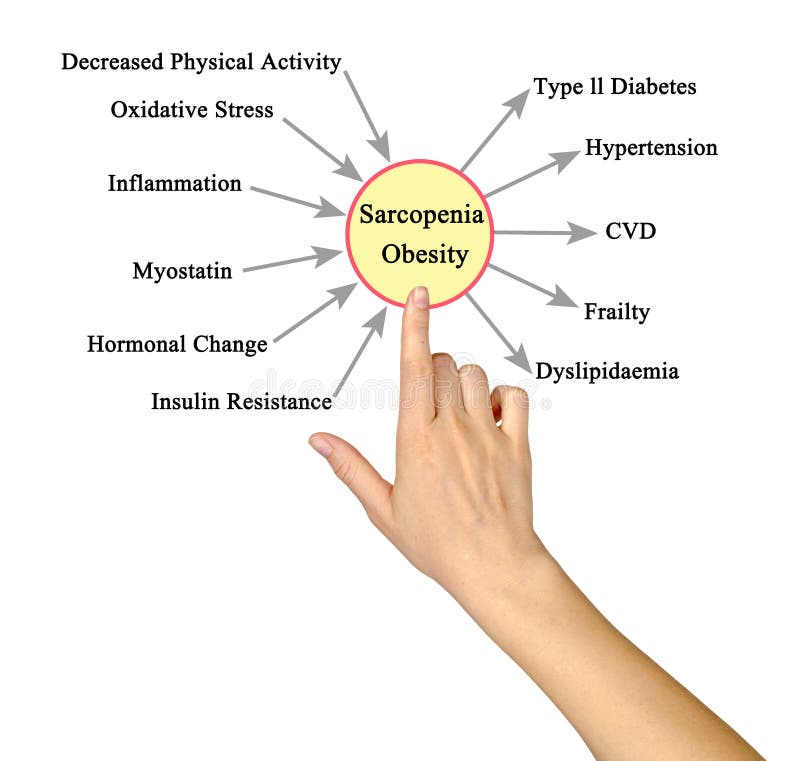 Causes and consequences. Causes of obesity. Health score.