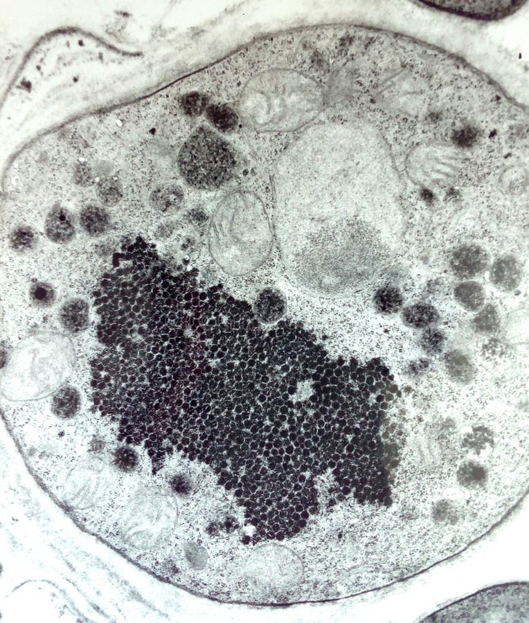 Electron microscopy of Virus infected cell. Cross section of of zika virus infected cell showing crystalline array of the viral particles in the cytoplasm of the royalty free stock images Electron microscopy of Virus infected cell. Cross section of of zika virus infected cell showing crystalline array of the viral particles in the cytoplasm of the royalty free stock images