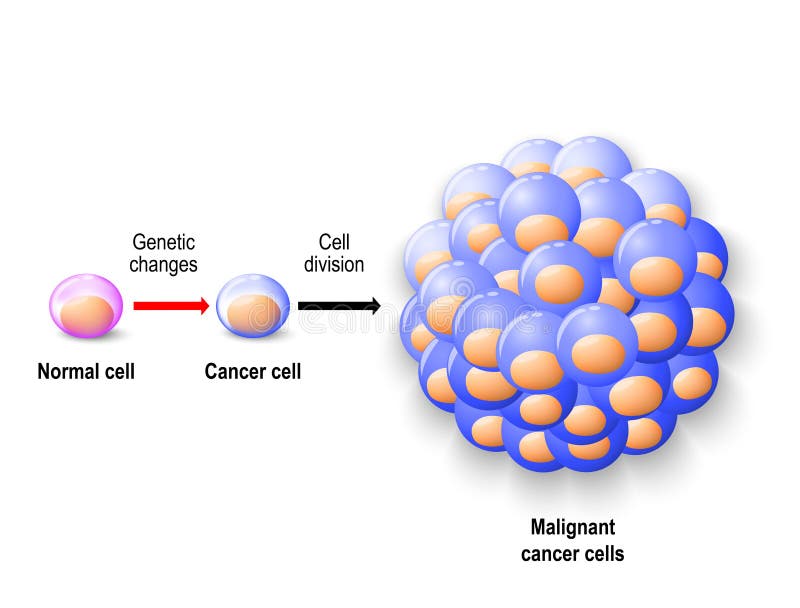 Cellula umana normale, cellula tumorale e cancro maligno illustrazione di stock Cellula umana normale, cellula tumorale e cancro maligno illustrazione di stock