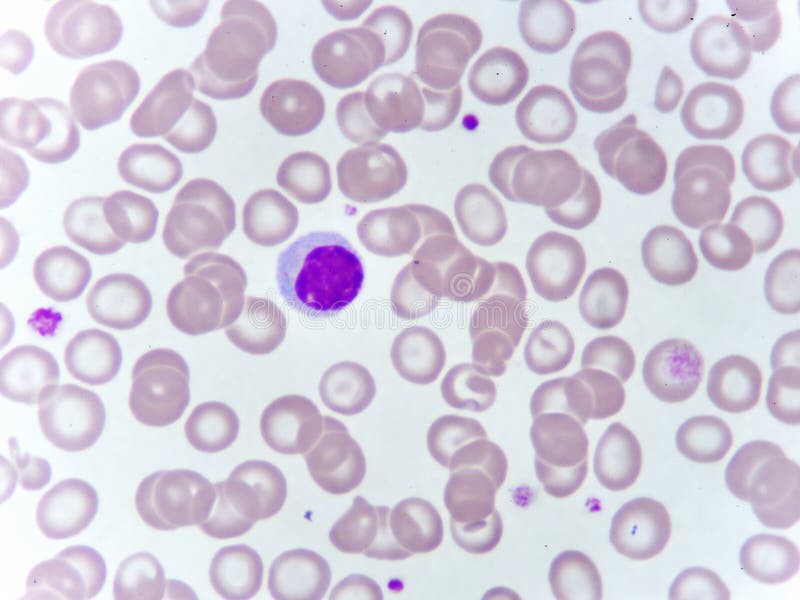 Cellule de lymphocyte dans la calomnie de sang images stock Cellule de lymphocyte dans la calomnie de sang images stock