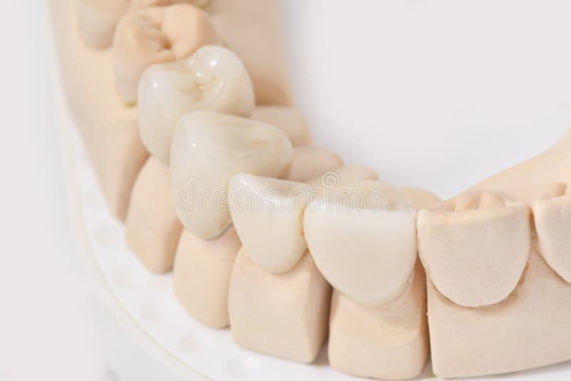 Crowns Stock Images Download 10,232 Royalty Free Photos