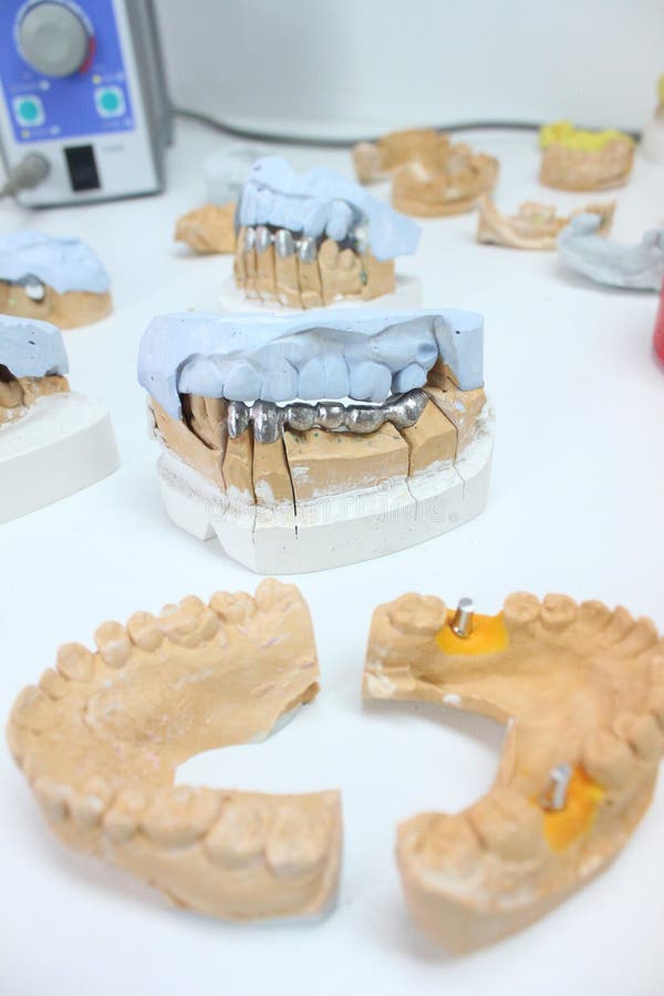 Ceramic Dental Crowns with Implants in a Lab Stock Photo Image of