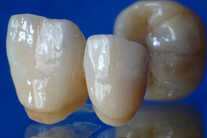 Ceramic zirconium. stock photo. Image of final, colour 90208766