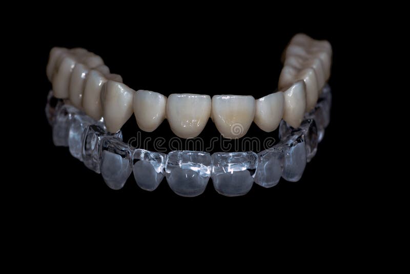 Ceramic Zirconium. Teeth. Dental Technician. Stock Photo Image of ceramic, works 136503588