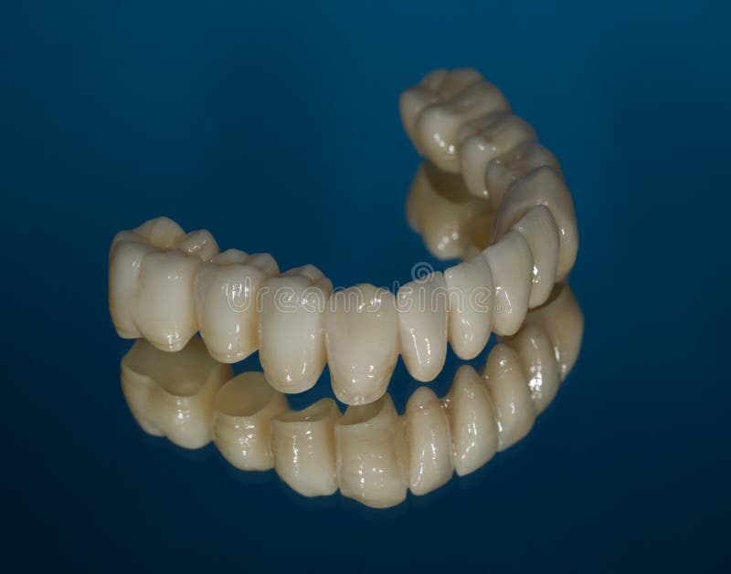 Ceramic Zirconium. Teeth. Dental Technician. Stock Photo Image of design, bridge 137696942