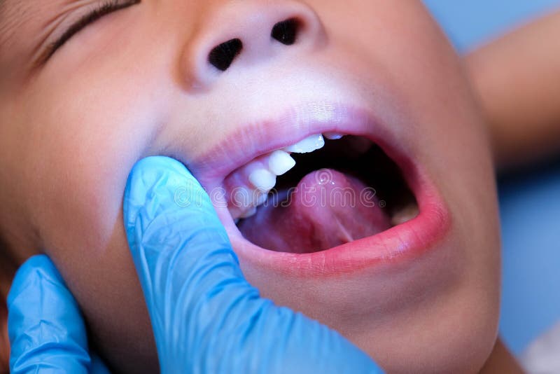 Niño Sonríe Con La Boca Cerrada Cerrando El Cierre De Un Concepto De Boca  De Niño Cuidado De La Piel De Niño Desarrollo Emocional Foto de archivo -  Imagen de oral, felicidad