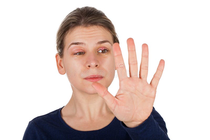  Chalazion - Augenlidinfektion lizenzfreie stockfotos