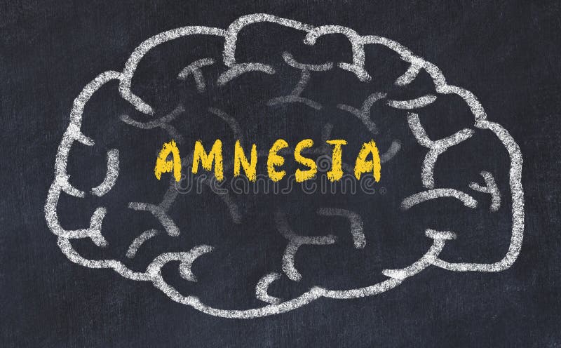 Chalk drawing of human brain with inscription amnesia stock photos