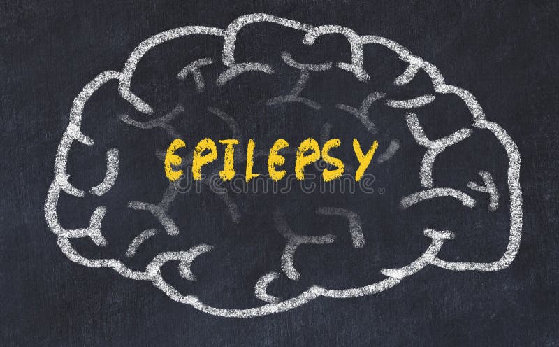 Chalk drawing of human brain with inscription epilepsy royalty free stock photo