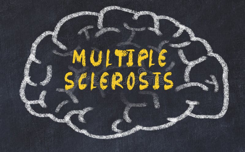 Chalk drawing of human brain with inscription multiple sclerosis stock image