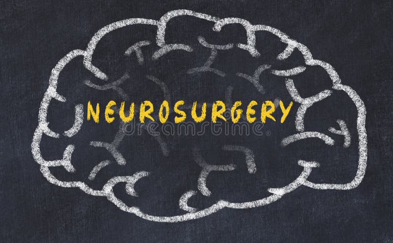 Chalk drawing of human brain with inscription neurosurgery royalty free stock images