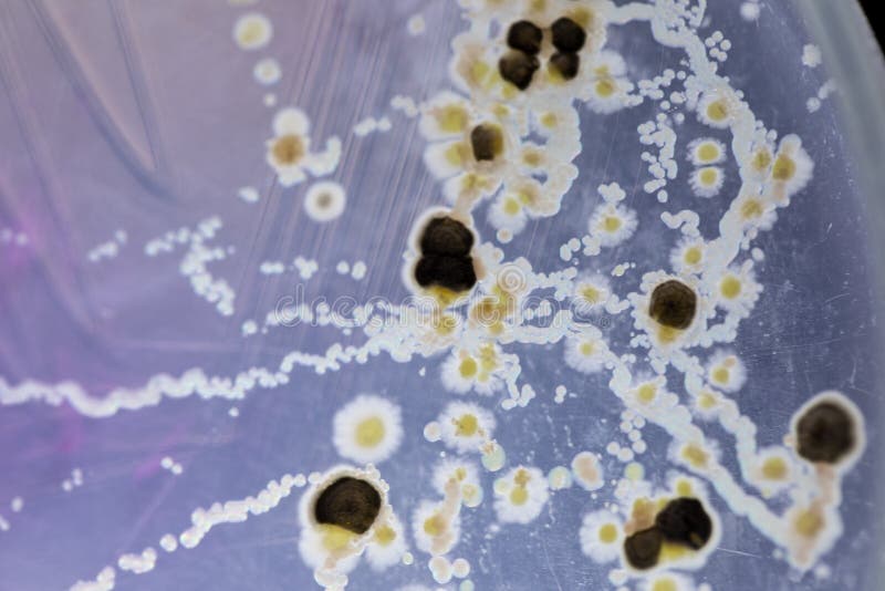 Characteristics and Different Shaped Colony of Bacteria and Mold