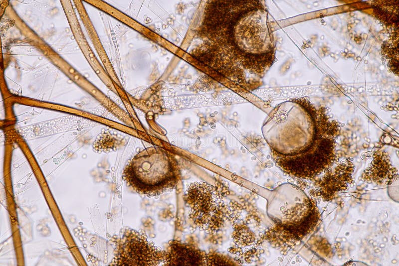 Rhizopus is a Genus of Common Saprophytic Fungi on Slide Under the
