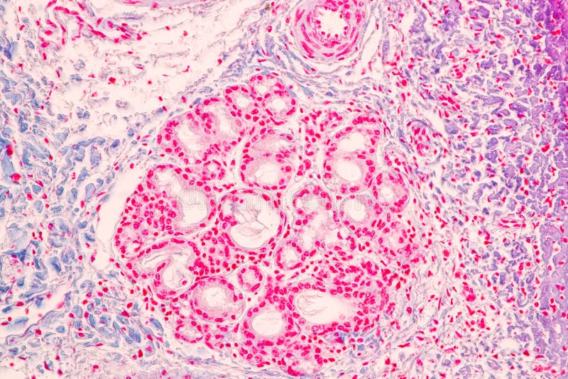 Characteristics Tissue of Olfactory Epithelium Human Under the ...