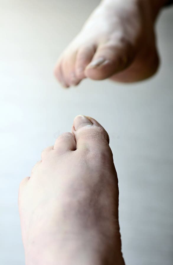 Diabetic Foot Mirror Stock Photos Free & RoyaltyFree Stock Photos