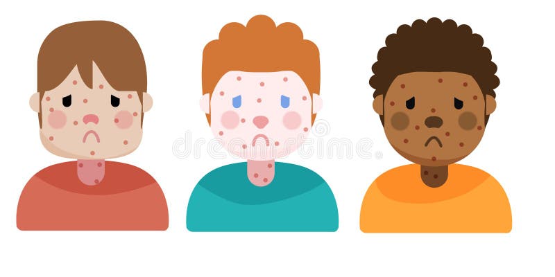 Chid sick with measles, illustration. Chid sick with measles, illustration