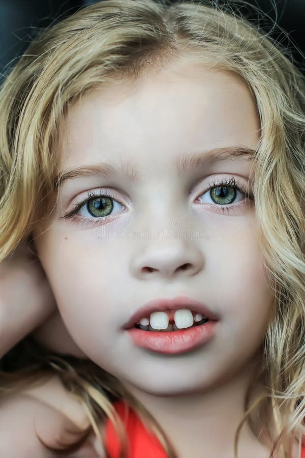 Headshot of a girl with autism looking at the camera seriously / sadly stoc...