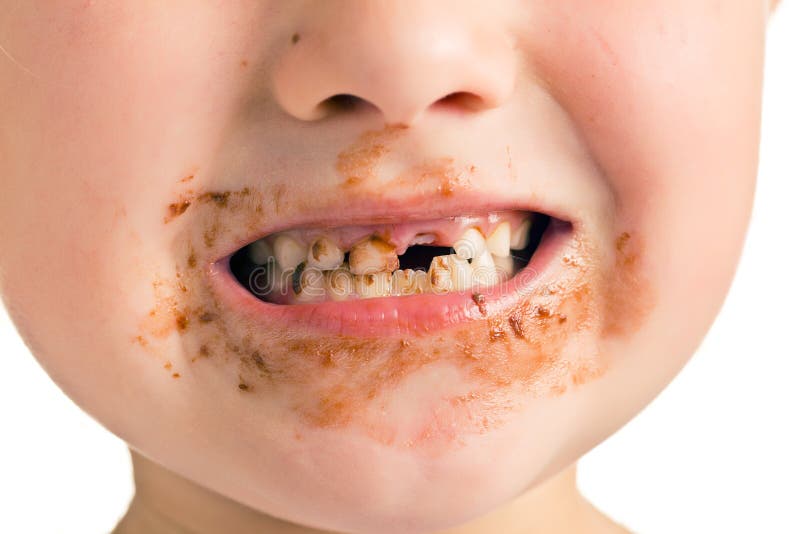 Child with a Dirty Mouth and Missing Tooth Stock Photo Image of human