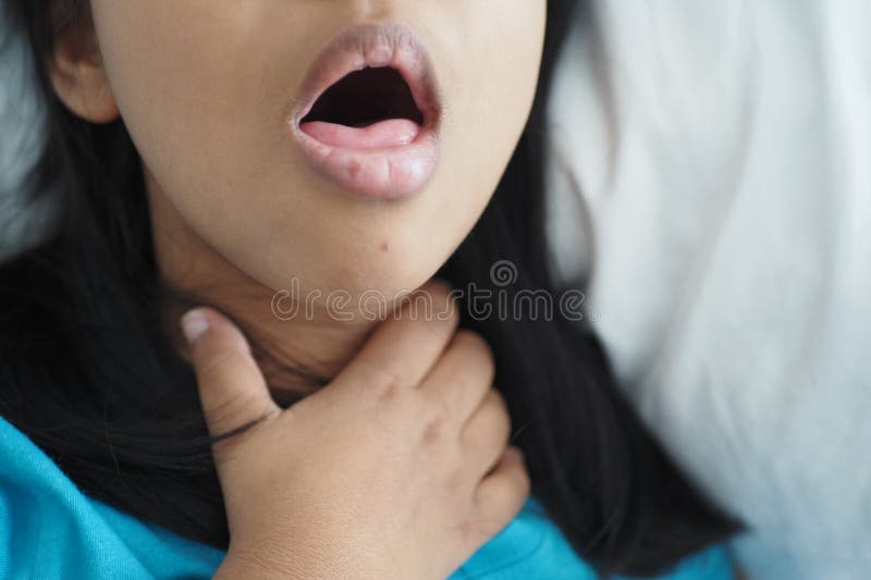 Child Got Flu Allergy Sneezing and Cough Stock Image Image of fever 300357575