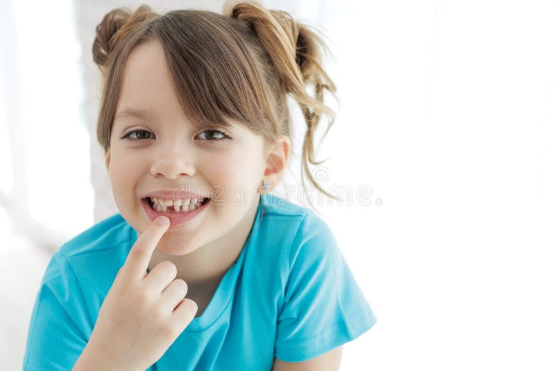 The Child Has Lost a Tooth. Little Girl without a Tooth. the First