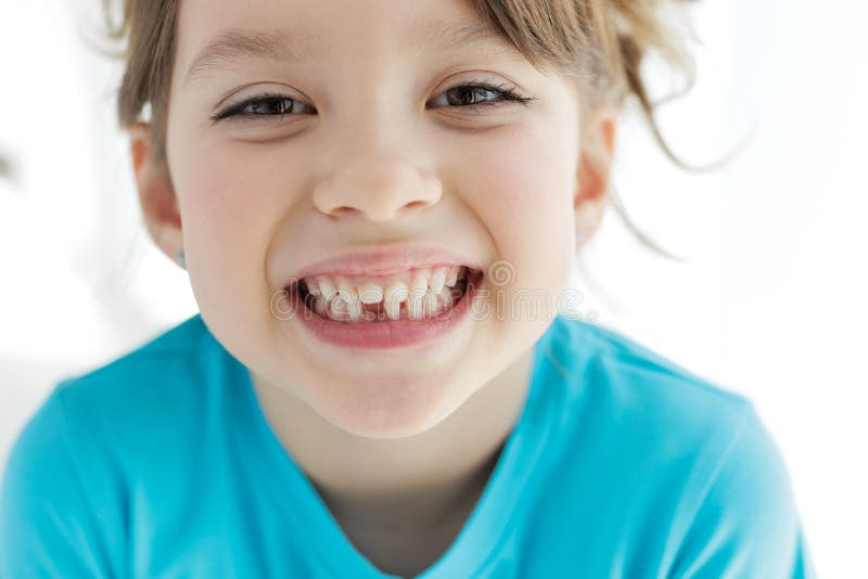 The Child Has Lost a Tooth. Little Girl without a Tooth. the First