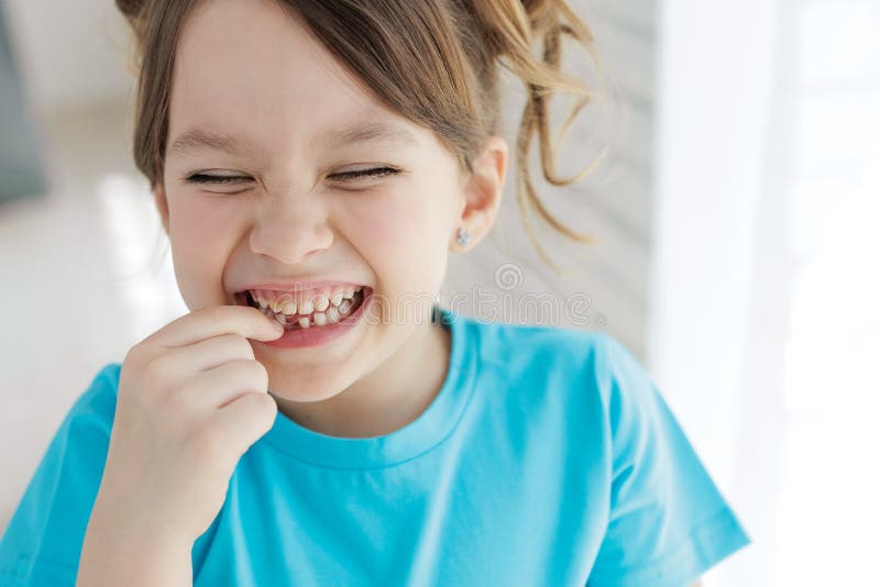 The Child Has Lost a Tooth. Little Girl without a Tooth. the First