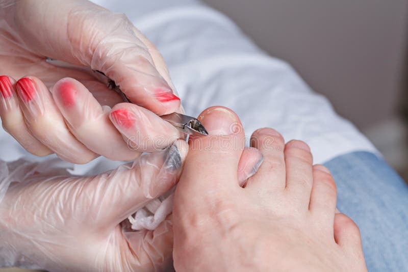 chiropody foto de stock royalty free chiropody foto de stock royalty free