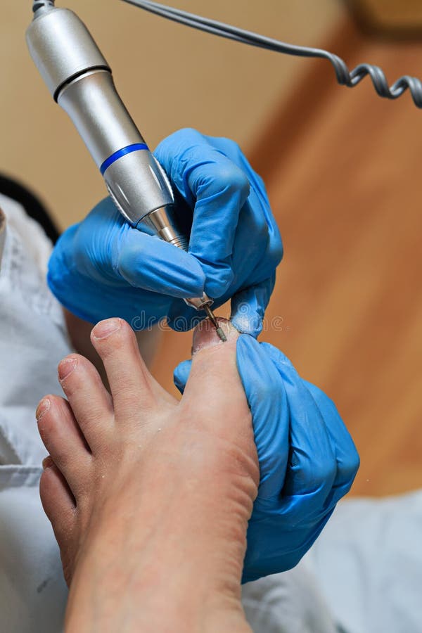 chiropody fotografia de stock chiropody fotografia de stock