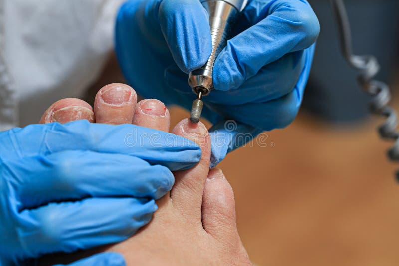 chiropody imagem de stock royalty free chiropody imagem de stock royalty free