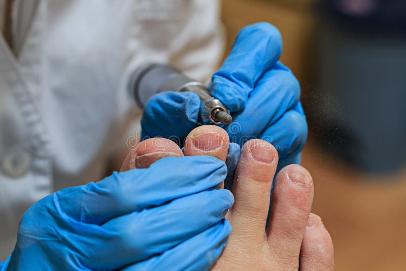 chiropody fotografia de stock royalty free chiropody fotografia de stock royalty free
