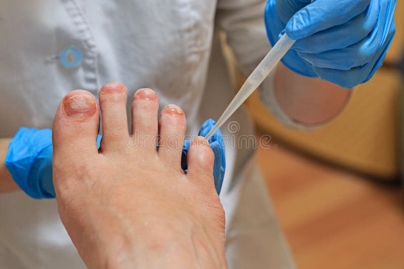 chiropody imagens de stock royalty free chiropody imagens de stock royalty free