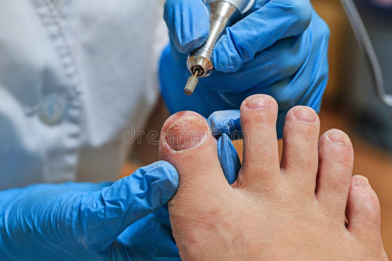 chiropody fotos de stock royalty free chiropody fotos de stock royalty free